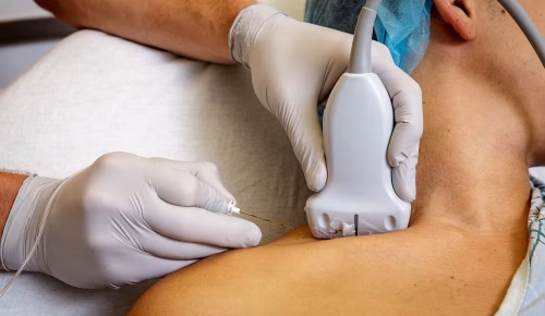 USGDiagnosticsTherapeuticIntervention USGDiagnosticsTherapeuticIntervention